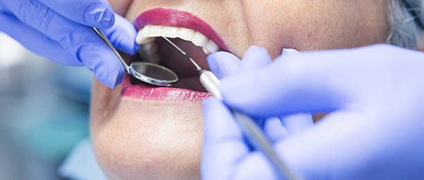 Best Emergency Wisdom Teeth Removal in Pelican Bay, FL